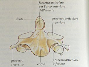 2° vertebra cervicale (epistrofeo)